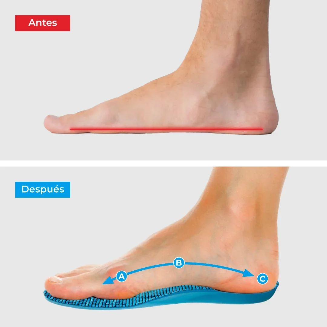 Adiós al dolor de pies 3