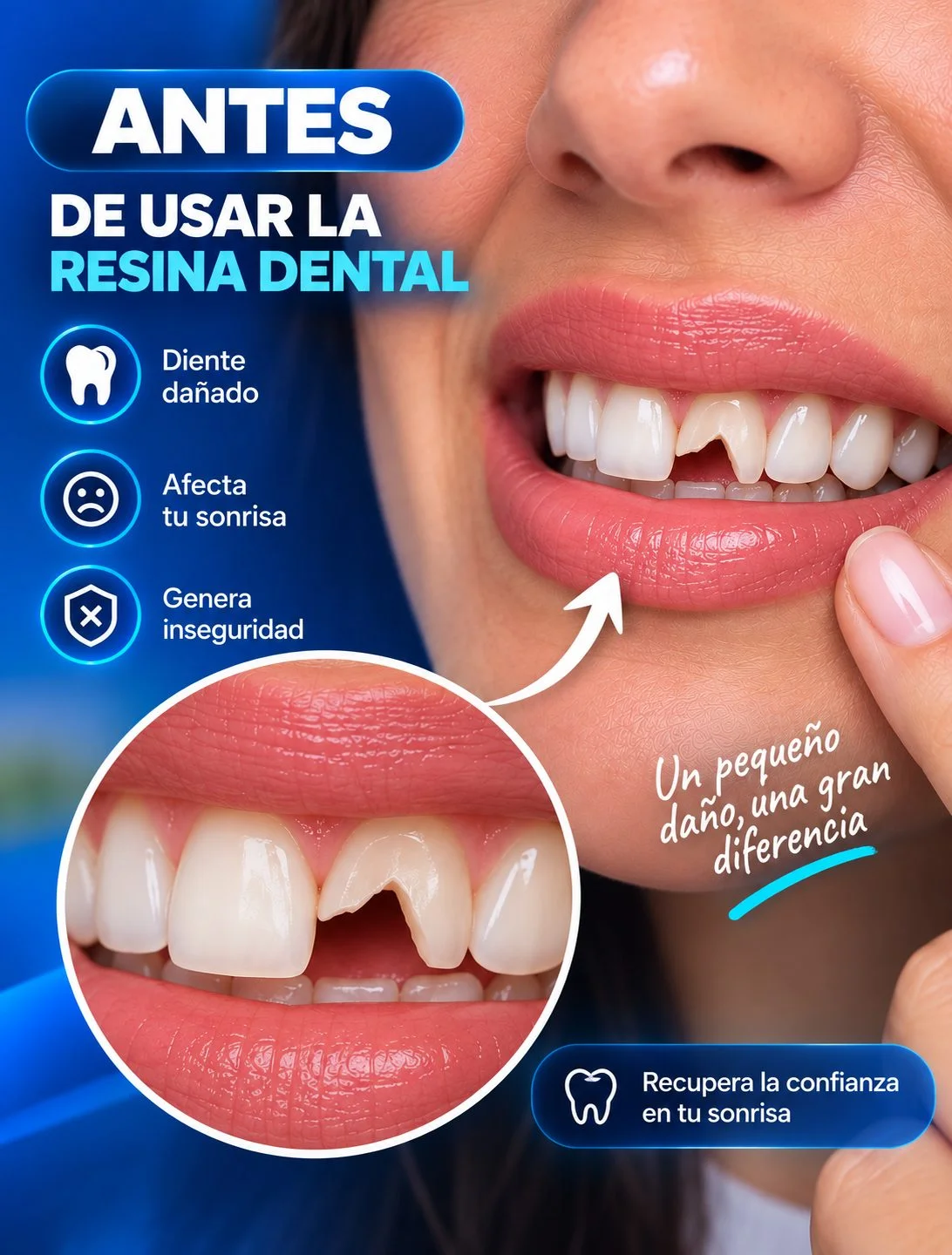 Antes